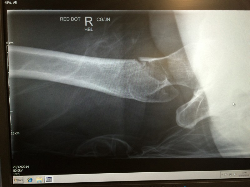 Do you think it's broken?